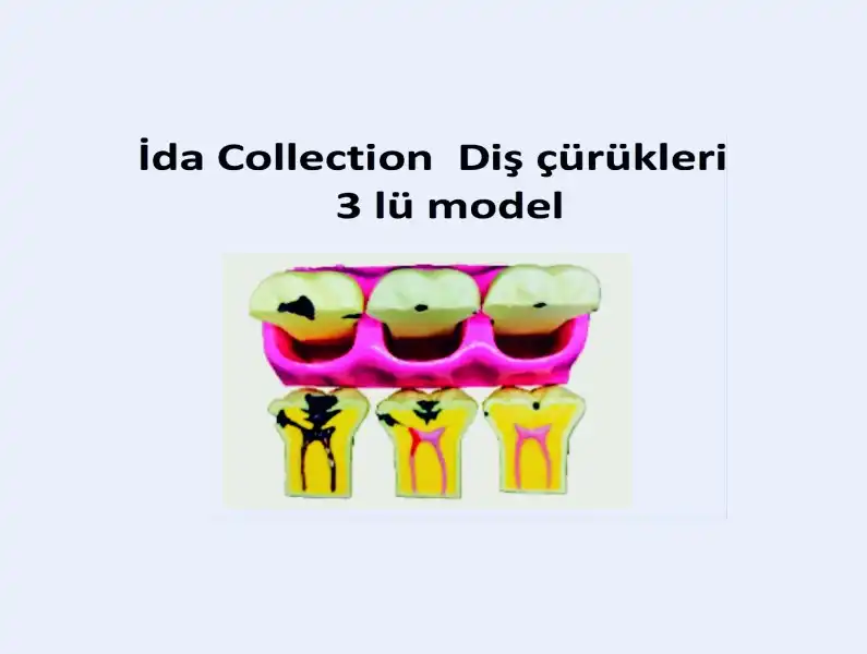 İDA COLLECTION DİŞ ÇÜRÜKLERİ (3 LÜ MODEL)