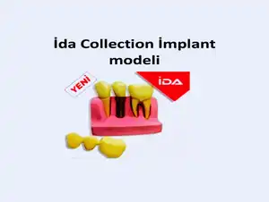 İDA COLLECTION IMPLANT MODELİ